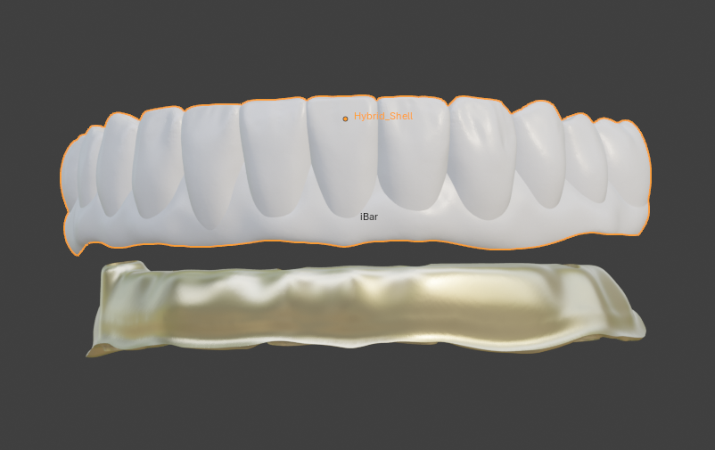 CAD render of a hybrid shell and iBar, occlusal view