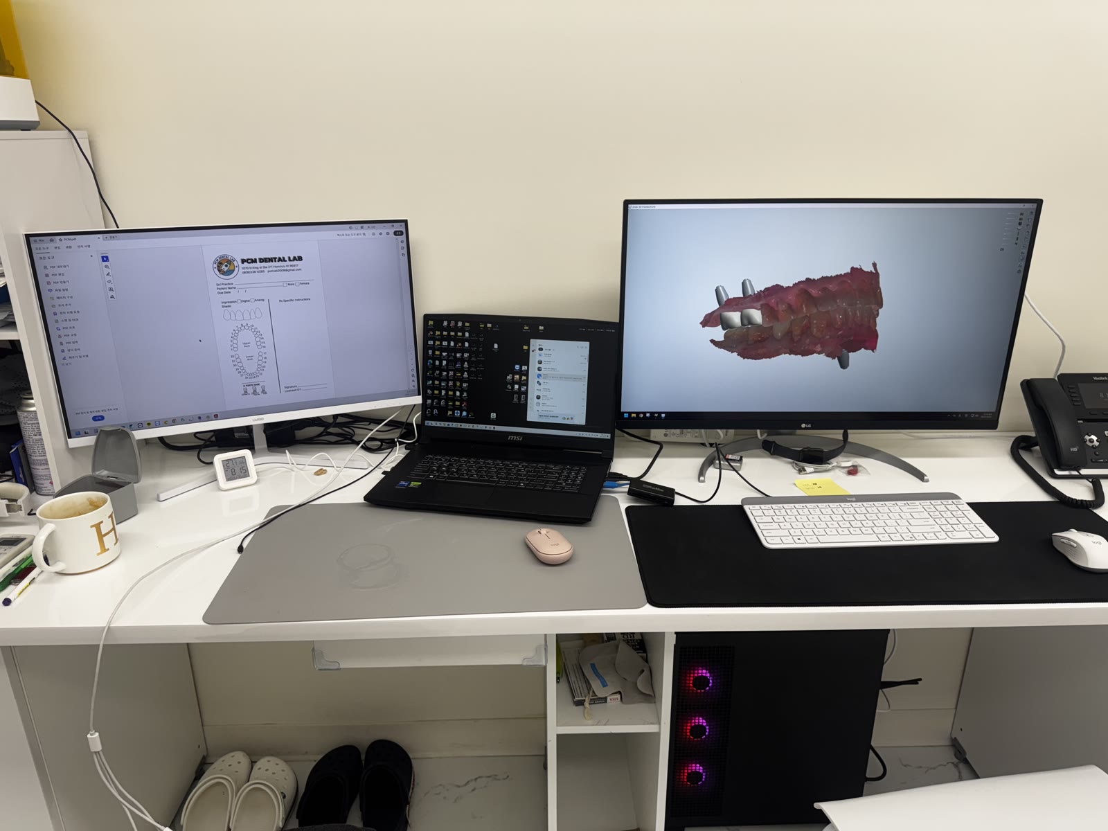 PCM Dental Lab Rx form and an intraoral scan on the design workstation